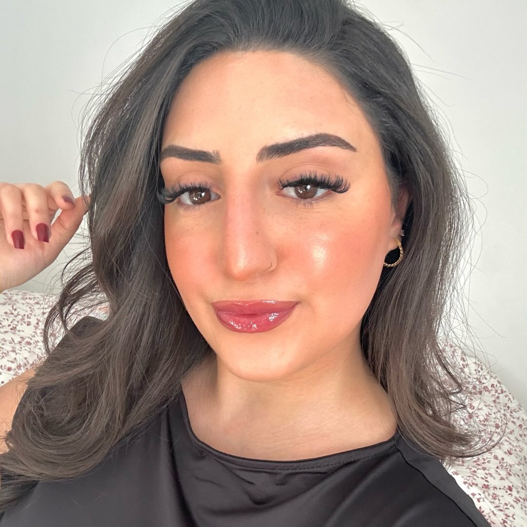 Instagram Profilbild von missxoers
