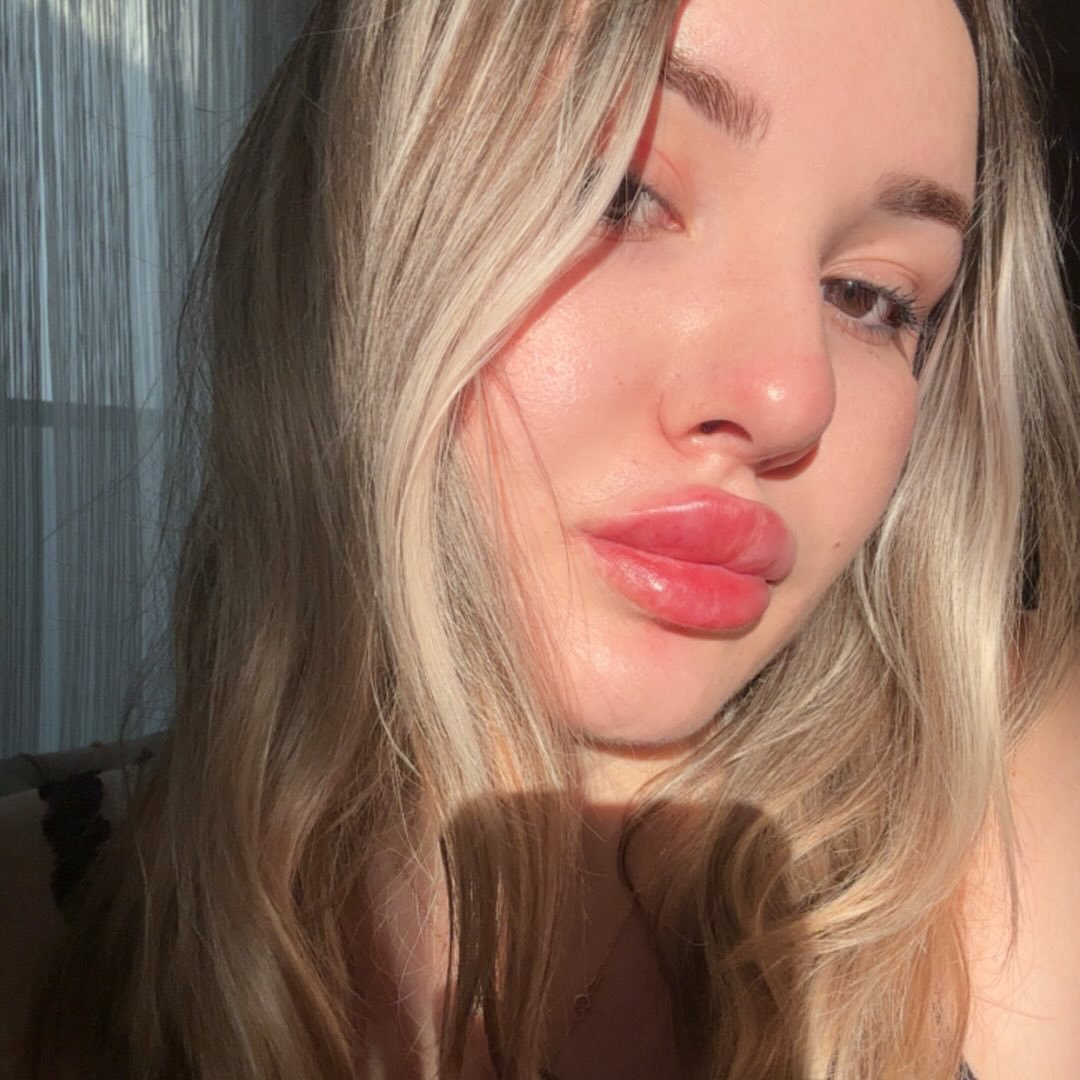 Instagram Profilbild von imjustpain